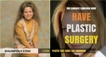 Candace Cameron Bure's Transformation: Plastic Surgery Speculations Explored