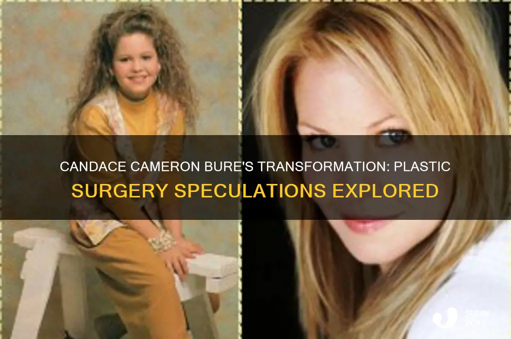 did candace cameron bure have plastic surgery