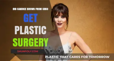 Candice Brown's Transformation: Plastic Surgery Rumors Explored