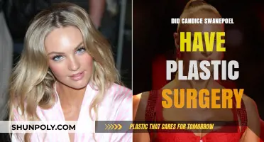 Candice Swanepoel Plastic Surgery: Fact-Checking the Rumors and Speculations