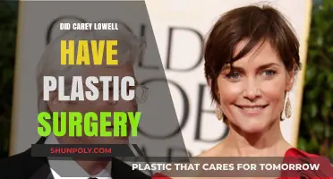 Carey Lowell's Transformation: Plastic Surgery Speculations and Truths Revealed
