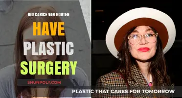 Carice van Houten's Transformation: Plastic Surgery Rumors Explored