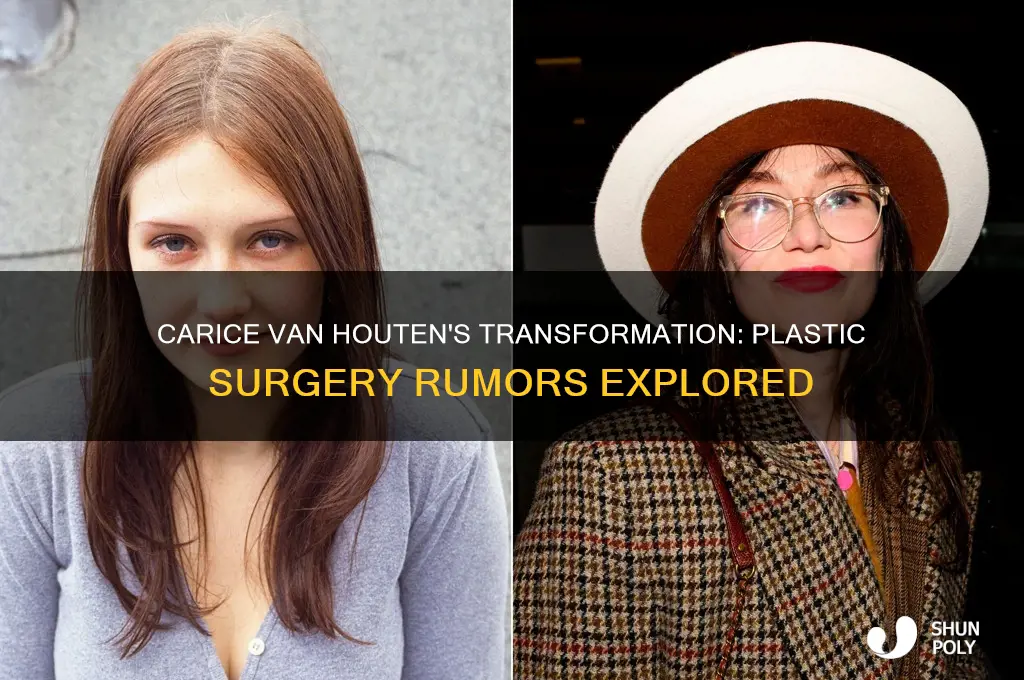 did carice van houten have plastic surgery