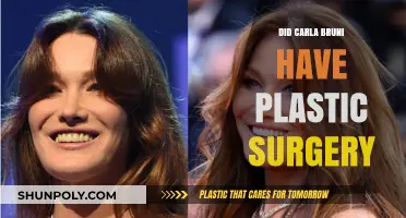 Carla Bruni Plastic Surgery: Fact or Fiction? Unveiling the Truth