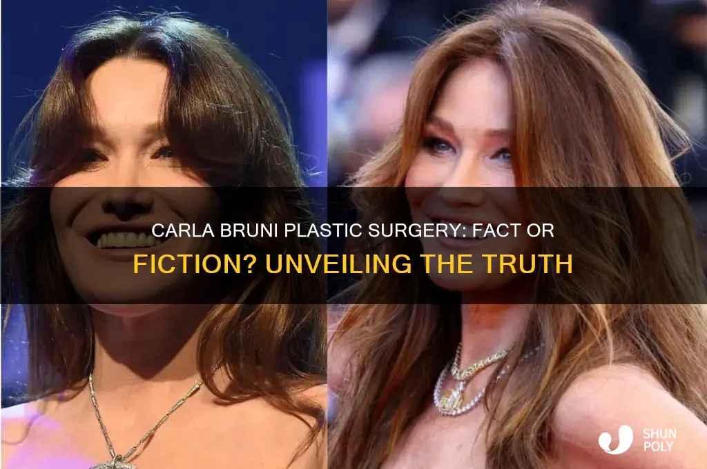 did carla bruni have plastic surgery