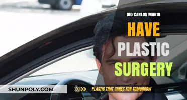 Carlos Marin's Transformation: Plastic Surgery Rumors Explored and Debunked