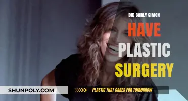 Carly Simon's Transformation: Plastic Surgery Speculations and Truths