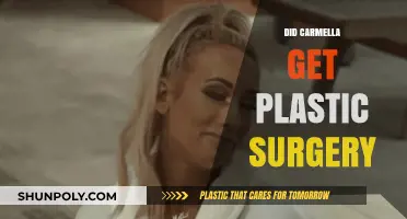 Did Carmella Undergo Plastic Surgery? Unveiling the Truth Behind Her Look