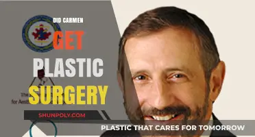Carmen's Transformation: Unveiling the Truth About Her Plastic Surgery