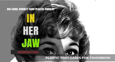 Carol Burnett's Jaw Transformation: Plastic Surgery Speculations Explored