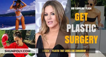 Caroline Flack's Transformation: Plastic Surgery Rumors Explored and Debunked