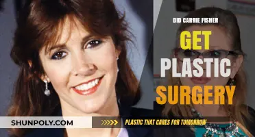 Carrie Fisher's Transformation: Plastic Surgery Speculations and Truths Revealed