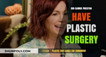 Carrie Preston's Transformation: Plastic Surgery Rumors Explored