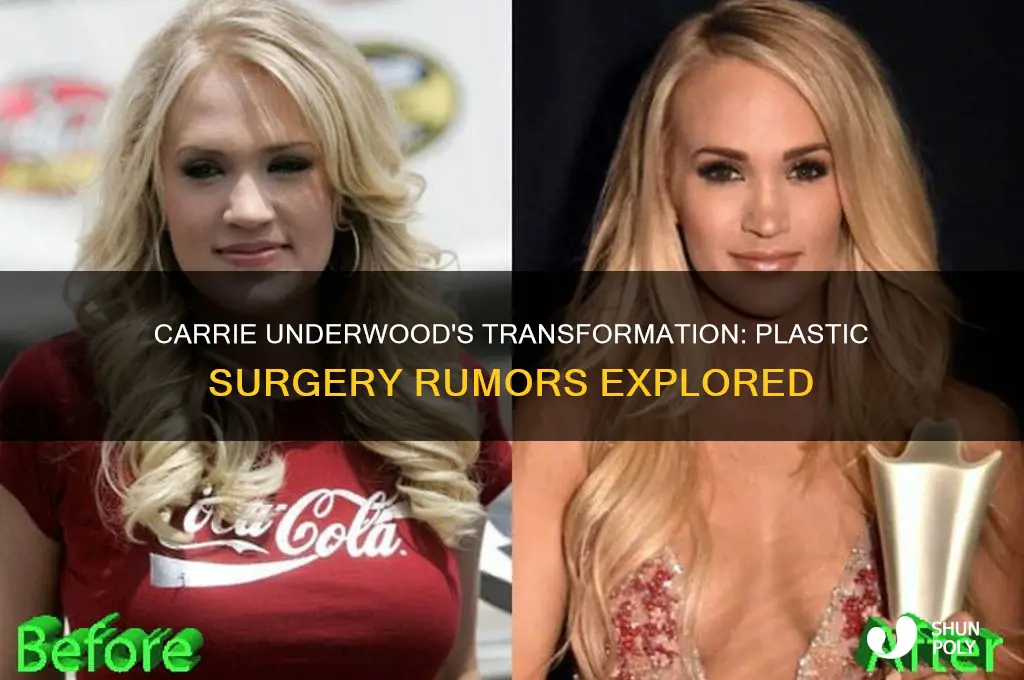 did carrie underwood get plastic