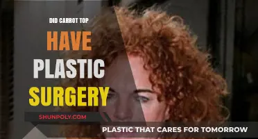 Carrot Top's Transformation: Plastic Surgery Rumors and Reality Revealed