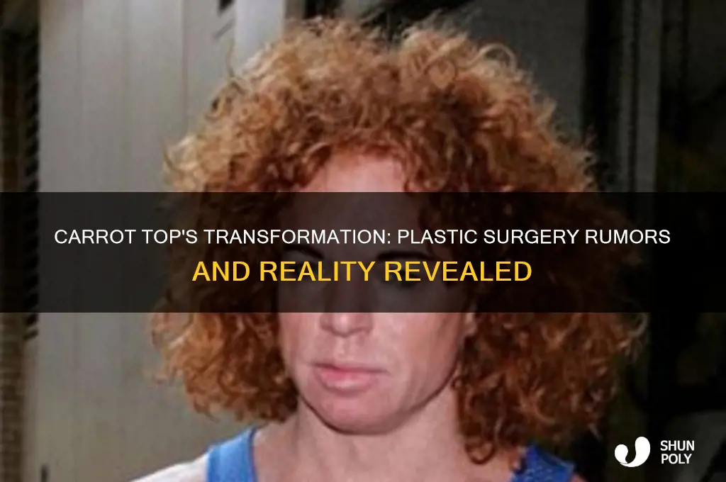 did carrot top have plastic surgery