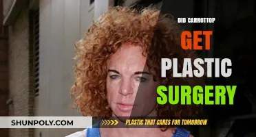 Did Carrot Top Undergo Plastic Surgery? Unraveling the Transformation Rumors