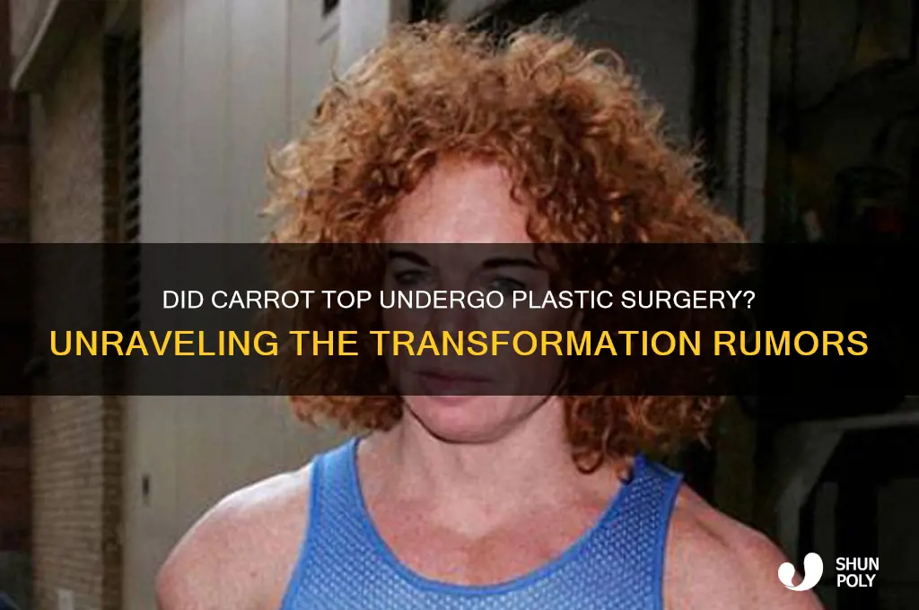 did carrottop get plastic surgery
