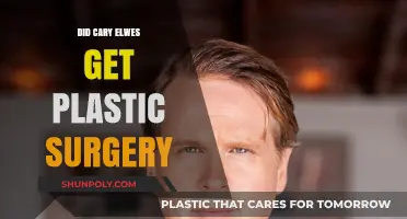 Cary Elwes Plastic Surgery: Fact-Checking the Transformation Rumors