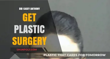 Casey Anthony's Transformation: Plastic Surgery Rumors and Speculations Explored