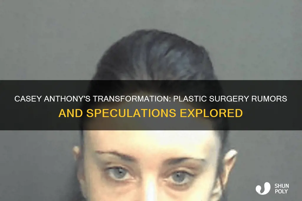did casey anthony get plastic surgery