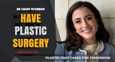 Cassidy Hutchinson's Transformation: Plastic Surgery Speculations and Facts