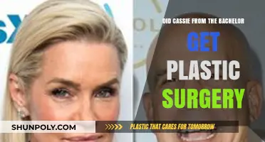 Cassie From The Bachelor: Plastic Surgery Rumors Explored