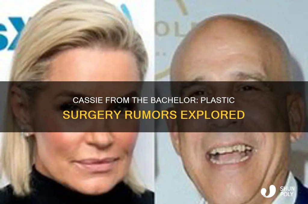 did cassie from the bachelor get plastic surgery