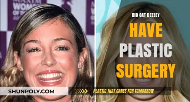 Cat Deeley Plastic Surgery: Fact-Checking the Transformation Rumors