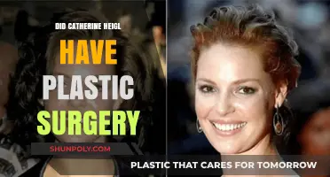 Catherine Heigl's Transformation: Plastic Surgery Rumors Explored