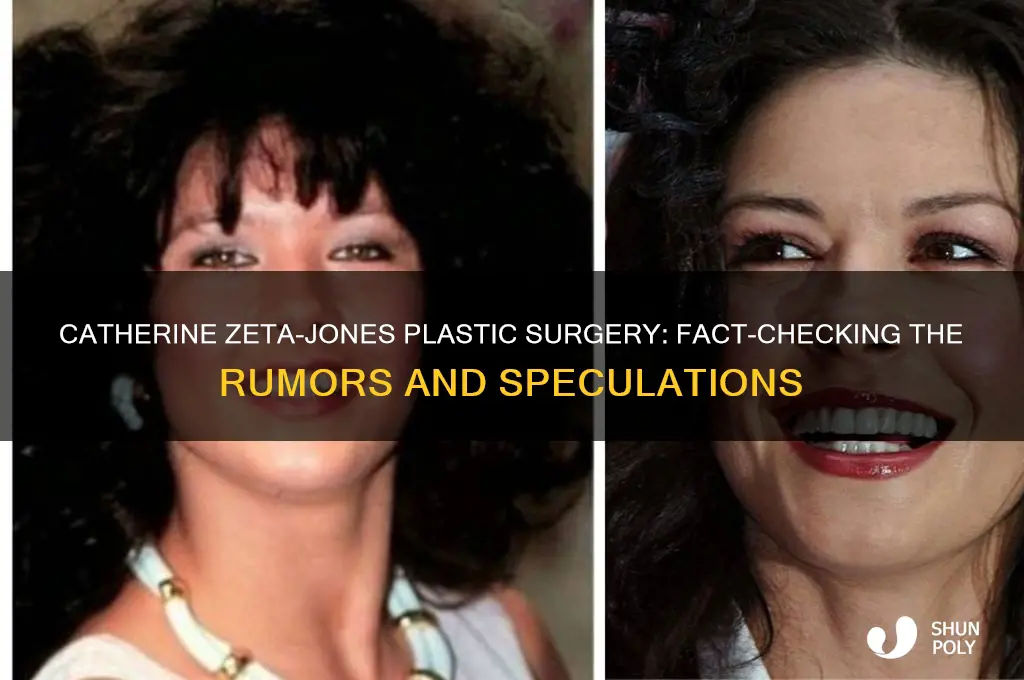 did catherine zeta jones get plastic surgery