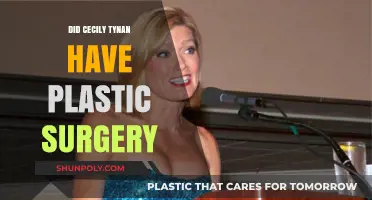 Cecily Tynan Plastic Surgery: Fact-Checking the Rumors and Speculations