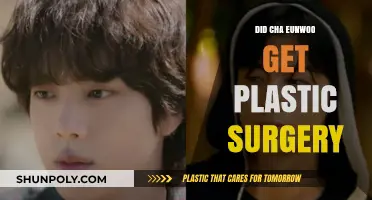 Cha Eunwoo Plastic Surgery: Fact-Checking the Rumors and Speculations