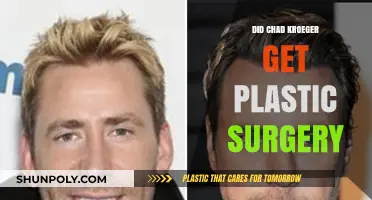 Chad Kroeger's Transformation: Plastic Surgery Rumors Explored