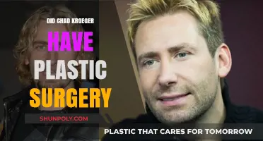 Chad Kroeger's Transformation: Plastic Surgery Rumors Explored