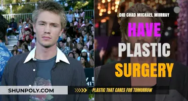 Chad Michael Murray's Transformation: Plastic Surgery Speculations Explored