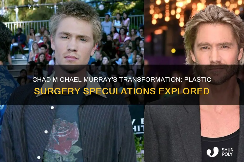 did chad michael murray have plastic surgery