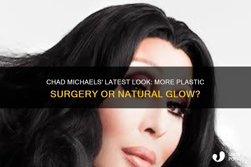 did chad michaels get more plastic surgery