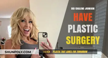 Chalene Johnson's Transformation: Plastic Surgery Rumors Explored and Debunked