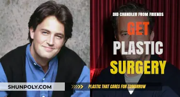 Chandler Bing's Transformation: Plastic Surgery Rumors Explored
