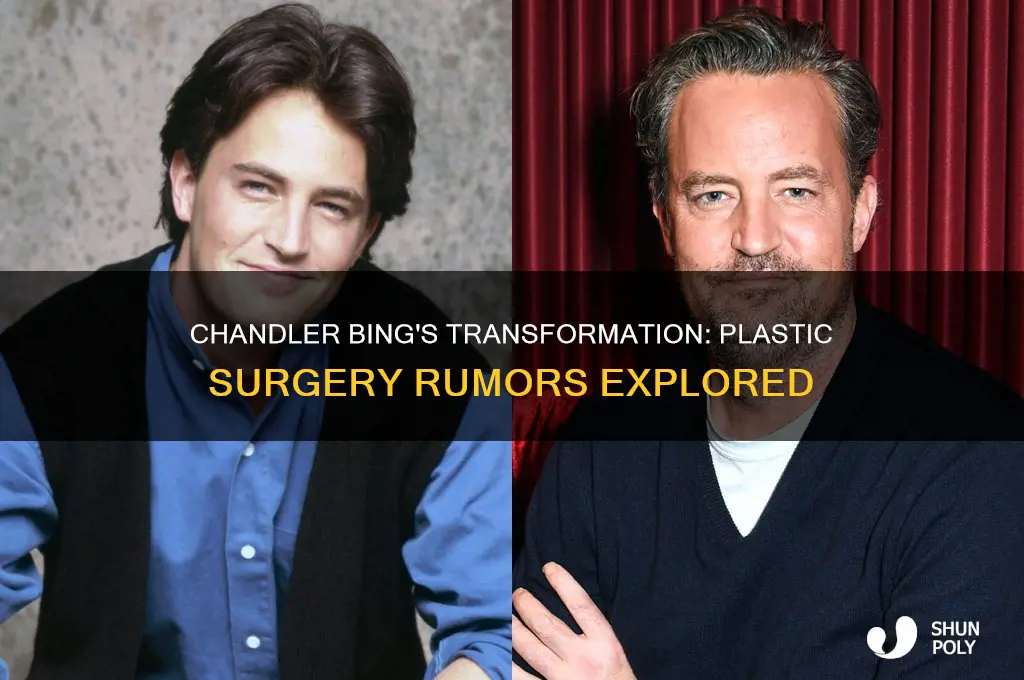 did chandler from friends get plastic surgery