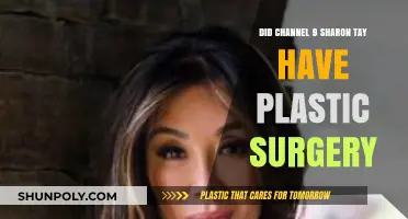 Sharon Tay's Transformation: Plastic Surgery Rumors on Channel 9