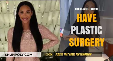 Chantel Everett's Transformation: Plastic Surgery Speculations and Truths