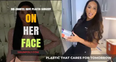 Chantel's Facial Transformation: Plastic Surgery Speculations and Truths