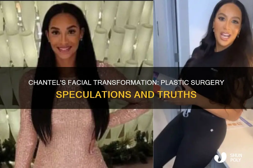 did chantel have plastic surgery on her face