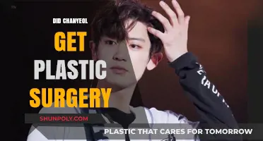 Chanyeol's Transformation: Plastic Surgery Rumors and the Truth Behind Them