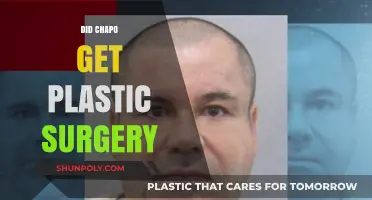 Unveiling the Truth: Did Chapo Undergo Plastic Surgery?