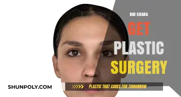 Chara's Transformation: Plastic Surgery Rumors and the Truth Behind Them