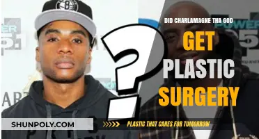 Charlamagne Tha God's Transformation: Plastic Surgery Rumors Explored