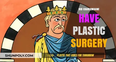 Charlemagne's Appearance: Unraveling the Plastic Surgery Mystery